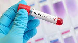 H1N1